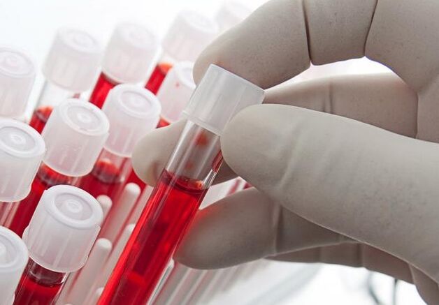 Εξέταση αίματος μετά την κατανάλωση αλκοόλ